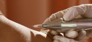 Plynová injekce. Přírodní plyn se aplikuje vpichem pod kůži. Oxid uhličitý má blahodárné účinky. Plynová injekce, Františkovy Lázně